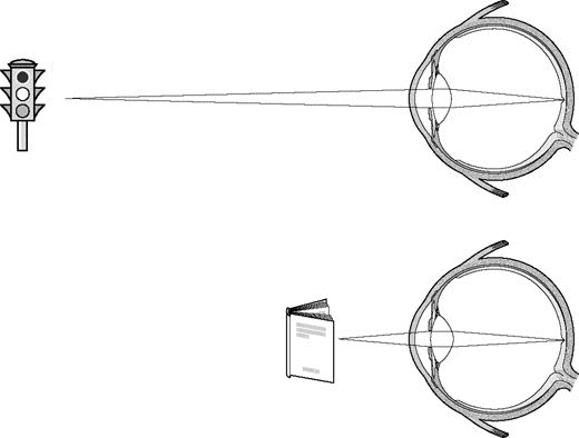 accommodation_presbyopia-dr khalil eye clinic in Cairo Egypt