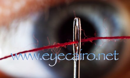 accommodation_presbyopia-dr khalil eye clinic in Cairo Egypt