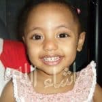 Wesam, 2 years after having her congenital or childhood glaucoma surgery by Dr Ahmad Khalil