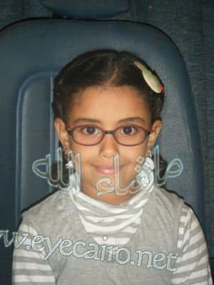 الطفلة منةبعد سبع سنوات من إجراء عملية الجلوكوما الخلقية الناجحة بواسطة د أحمد خليل