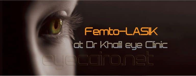 Femto-lasik (ultra-lasik, ilasik) at Dr Khalil Eye Clinic in Cairo Egypt